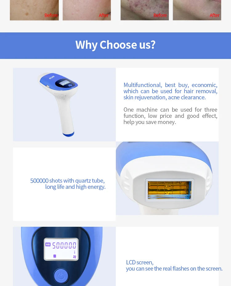 Mlay T3 IPL Hair removal Epilator a Laser Permanent Malay Hair Removal Machine Body Electric depilador a Laser 500000 Flashes