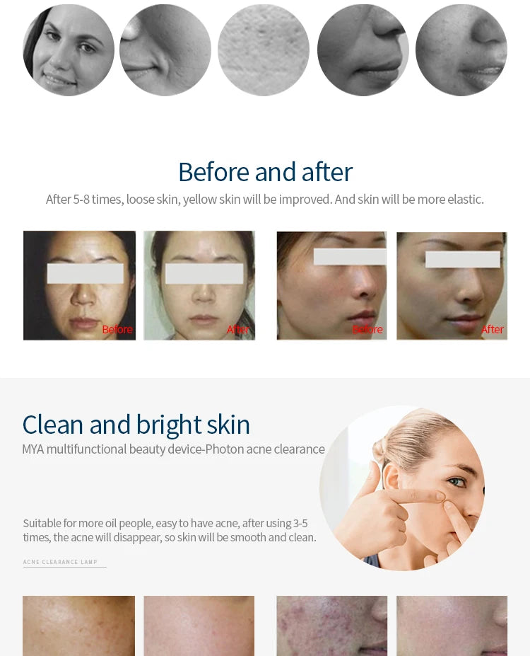 Mlay T3 IPL Hair removal Epilator a Laser Permanent Malay Hair Removal Machine Body Electric depilador a Laser 500000 Flashes